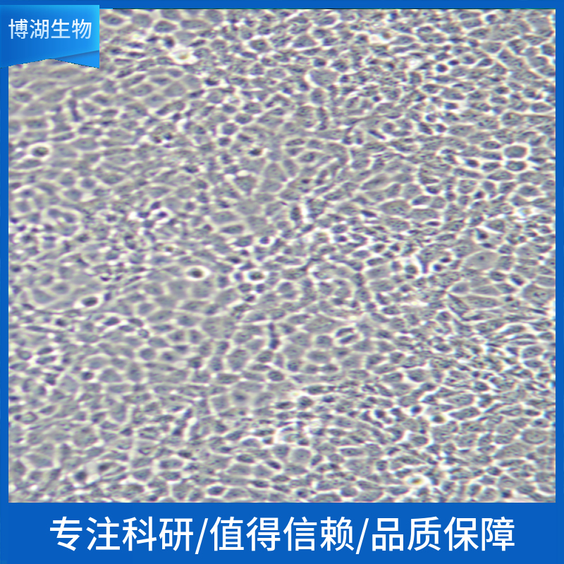 SK-N-SH人神经母细胞瘤细胞,SK-N-SH