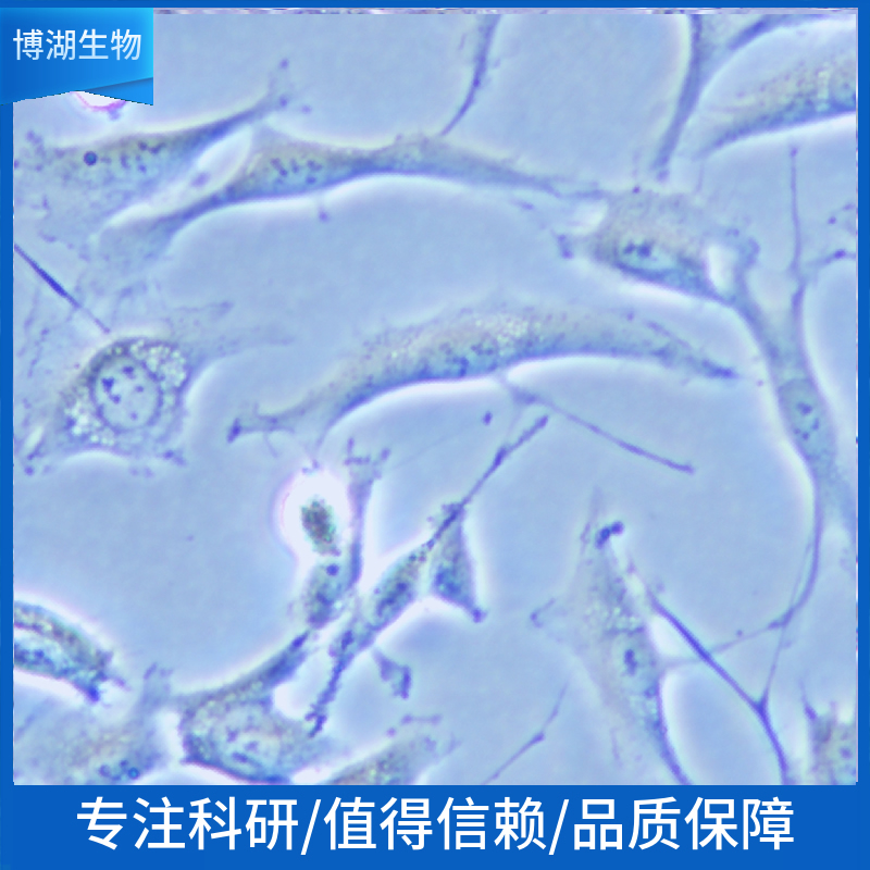 SIHa人子宫颈鳞癌细胞,SIHa