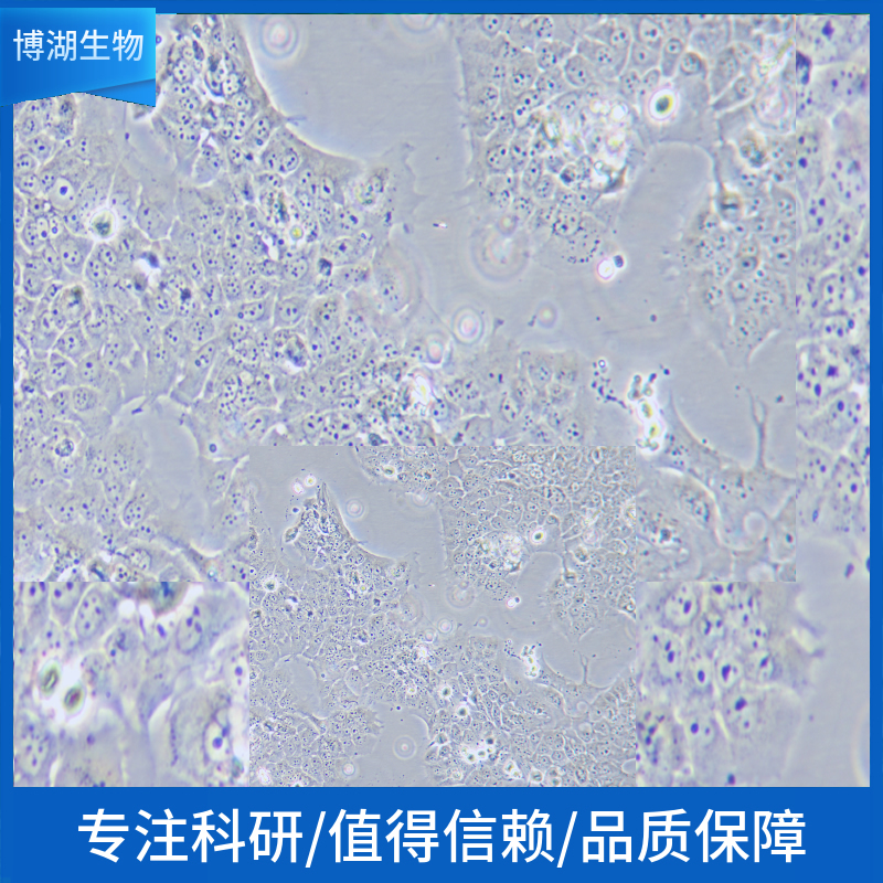sv-huc-1人膀胱上皮永生化细胞,sv-huc-1