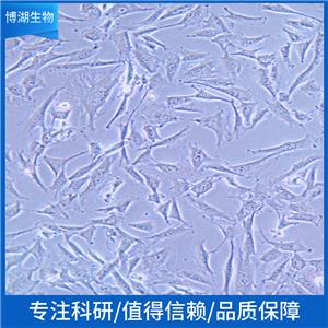 人Burkitt's淋巴瘤细胞+LUC+eGFP;Daudi-LUC-eGFP-puro