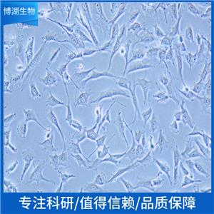 人B淋巴细胞瘤细胞+luc;RAMOS-LUC-PURO