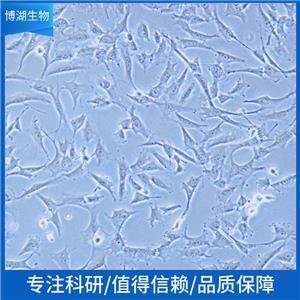 人B细胞淋巴瘤；U2932