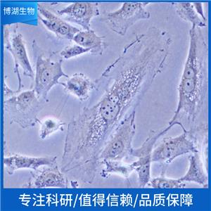 人肝癌细胞;HEP3B-LUC-EGFP