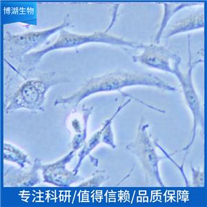 SIHa人子宫颈鳞癌细胞