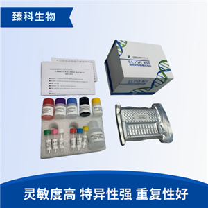 大鼠唾液淀粉酶(AMY）elisa试剂盒