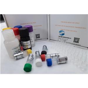 人分泌性热休克蛋白90(SHSP-90)ELISA试剂盒