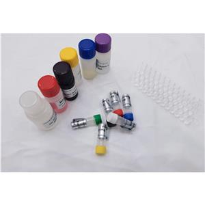 人丙二酸单酰辅酶A(MCA)ELISA试剂盒