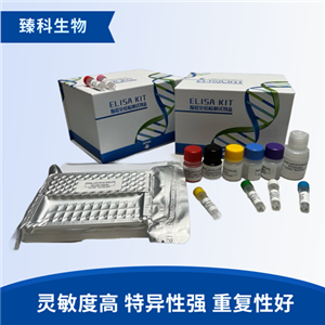 大鼠抗肺泡基底膜抗体(ABM-Ab）elisa试剂盒