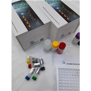 人高迁移率族蛋白B1-IgG抗体(HMGB-1-IgG)ELISA试剂盒