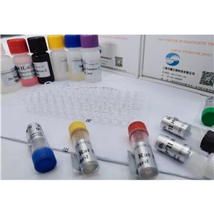 人高迁移率族蛋白B1-IgM抗体(HMGB-1-IgM)ELISA试剂盒