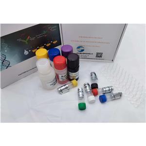 人高迁移率族蛋白B1-IgA抗体(HMGB-1-IgA)ELISA试剂盒