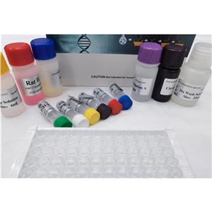 人高迁移率族蛋白B1-IgA抗体(HMGB-1-IgA)ELISA试剂盒