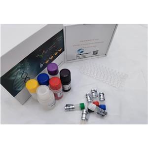 人抗卵巢抗体(Anti-OV Ab)ELISA试剂盒