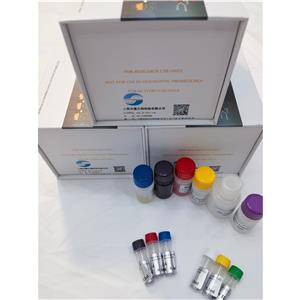 人抗卵巢抗体(Anti-OV Ab)ELISA试剂盒