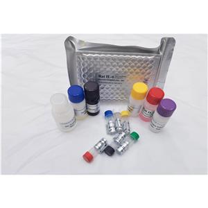 人酪氨酸蛋白激酶ABL1(ABL1)ELISA试剂盒