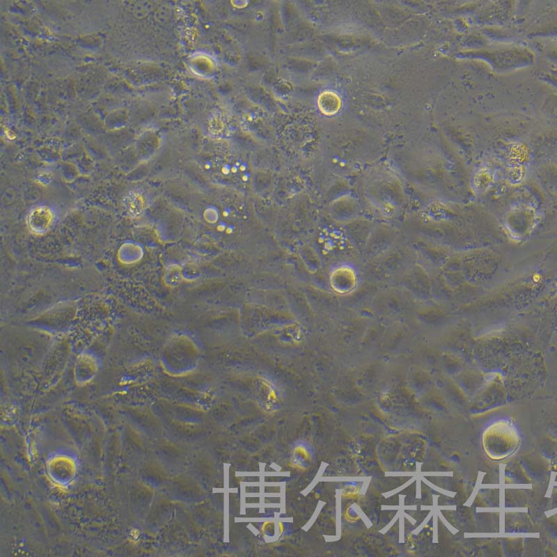 SNU878细胞（人肝癌细胞）,SNU878