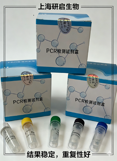 禽流感病毒H9N2亚型（AIV-H9N2）核酸检测试剂盒（双重荧光PCR法）