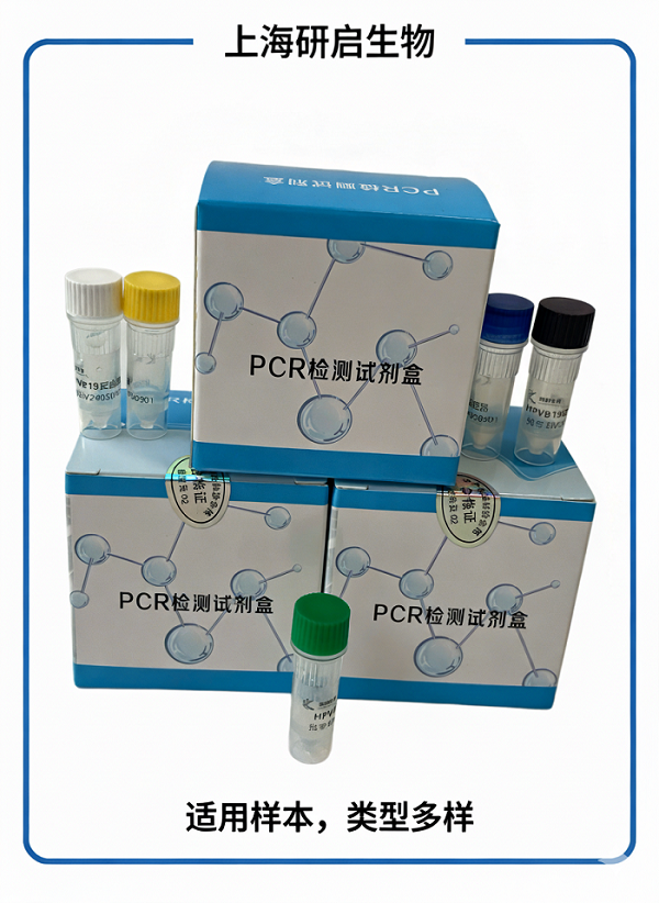 小反刍兽疫通用型/疫苗株/野毒株（PPR-U/ PPR-V/ PPR-W）核酸检测试剂盒（三重荧光-PCR法）