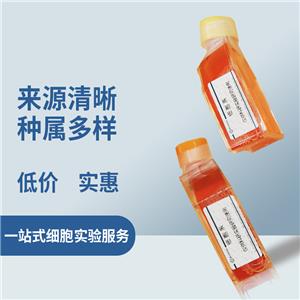 SNU-886细胞（人胃癌细胞）,SNU-886