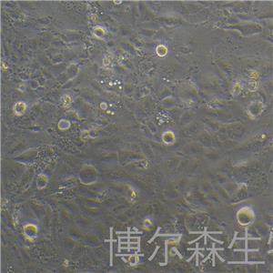 SNU878细胞（人肝癌细胞）,SNU878