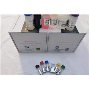 人C1q肿瘤坏死因子相关蛋白5(CTRP5)ELISA试剂盒