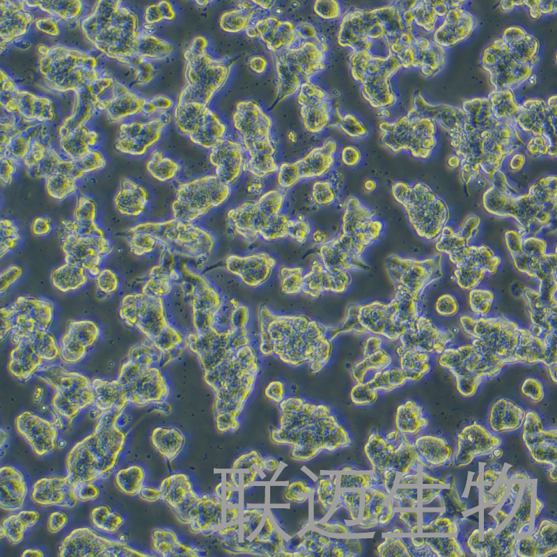 SNU-719细胞（胃癌细胞）LM8C0633,SNU-719