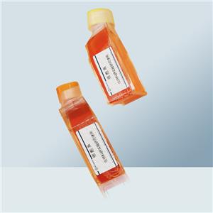 TE-7细胞（人食管癌细胞）,TE-7