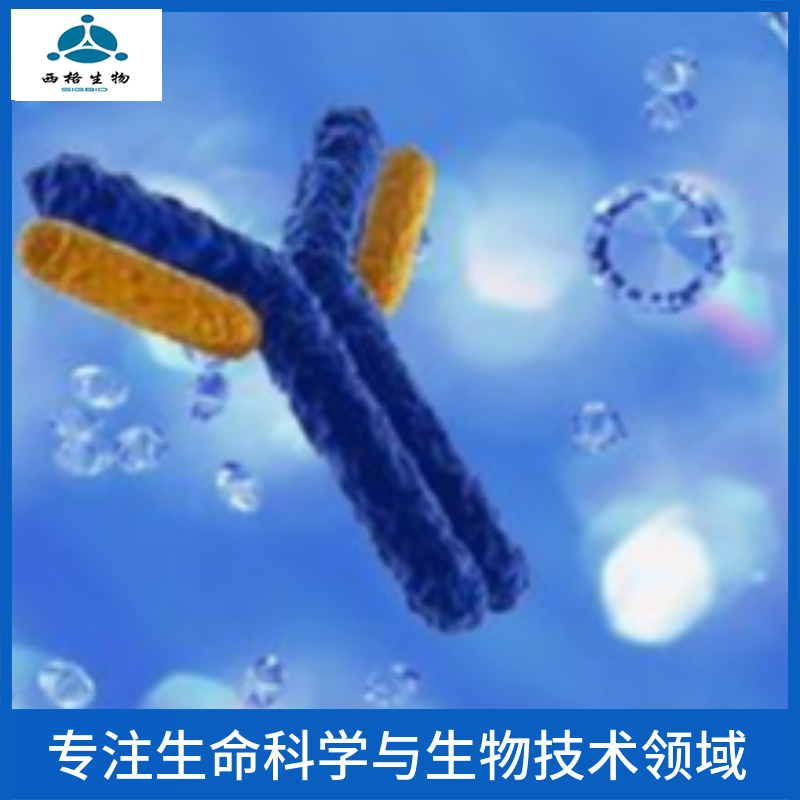 Iroquois同源蛋白5抗体,IRX5 Rabbit pAb