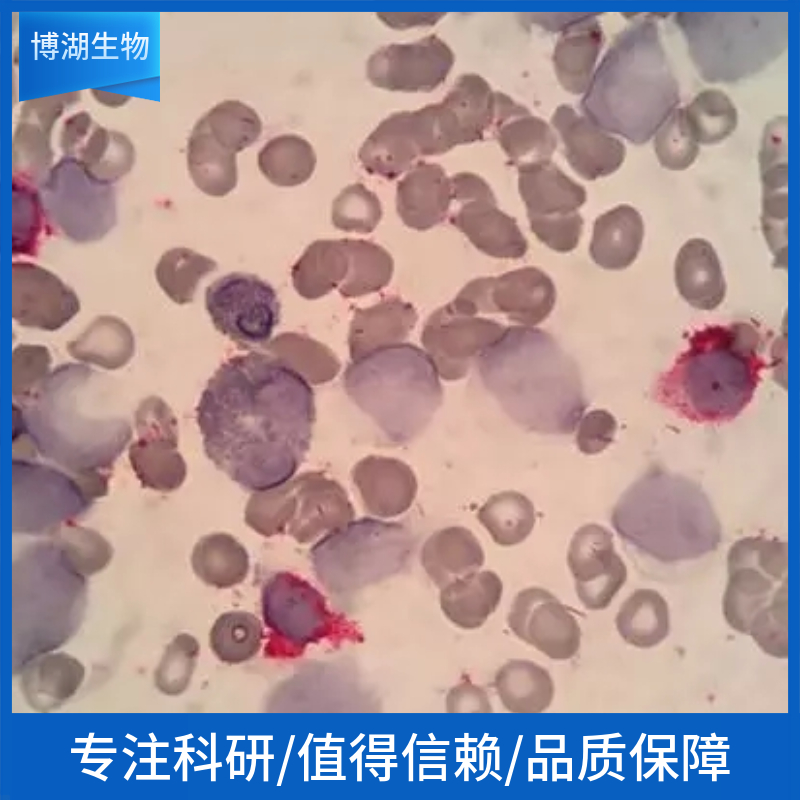 人肝癌细胞-荧光素酶标记;HEP3B-LUC-PURO,HEP3B-LUC-PURO