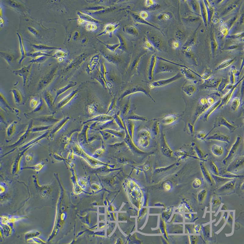 MDA-MB-231-GFP细胞（乳腺癌细胞绿色荧光蛋白标记）LM8C0150-G,MDA-MB-231-GFP