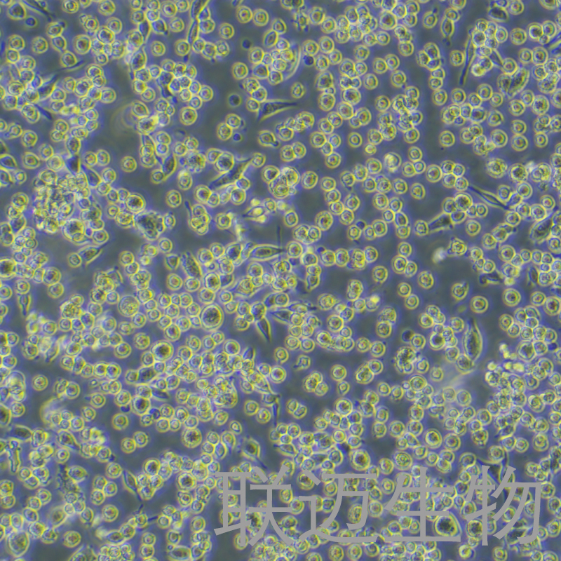 LLC-LUC-GFP细胞（小鼠肺癌细胞-绿色荧光蛋白-荧光素酶标记）LM8C0140-LG,LLC-LUC-GFP