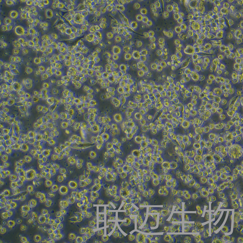 H22-LUC-GFP细胞（小鼠肝癌细胞-绿色荧光蛋白-荧光素酶标记）LM8C0341-LG,H22-LUC-GFP