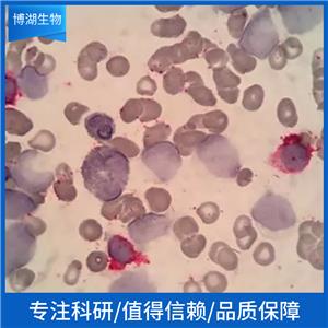 人肝癌细胞-荧光素酶标记;HEP3B-LUC-PURO