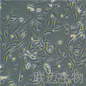 MDA-MB-231-GFP细胞（乳腺癌细胞绿色荧光蛋白标记）LM8C0150-G,MDA-MB-231-GFP